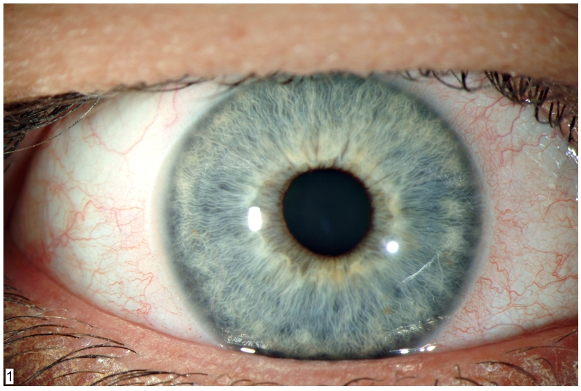 close up of eye